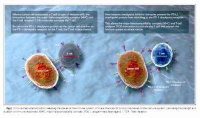 154-155全球肿瘤快讯_页面_10_图像_0001.jpg 154-155全球肿瘤快讯_页面_10_图像_0001.jpg