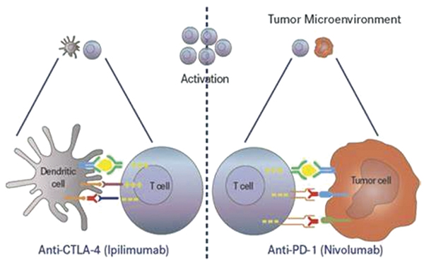 转移性葡萄膜黑色素瘤 纳武利尤单抗联合伊匹单抗有效