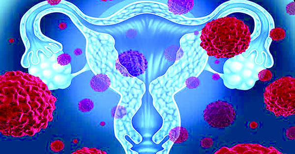 子宫异常出血女性子宫癌 WID-qEC检测较超声检查性能更好