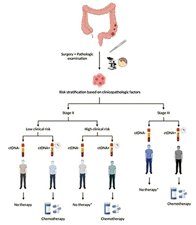 结直肠癌MRD检测 肿瘤先验分析与肿瘤未知分析优劣对比研究