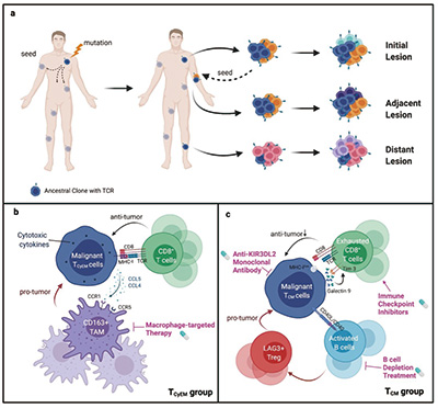侵袭性CTCL中的TCR克隆亚型研究