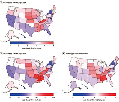 美国过去三十年中枢神经系统肿瘤负担分析