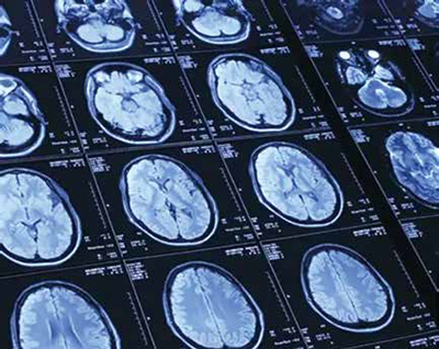 389-390期《全球肿瘤快讯》-27.jpg 389-390期《全球肿瘤快讯》-27.jpg