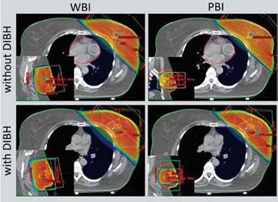 389-390期《全球肿瘤快讯》-54-.jpg 389-390期《全球肿瘤快讯》-54-.jpg