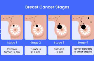 389-390期《全球肿瘤快讯》-61.jpg 389-390期《全球肿瘤快讯》-61.jpg