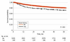 上尿路尿路上皮癌 肾结石病史或影响患者生存结局