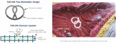 389-390期《全球肿瘤快讯》-75-.jpg 389-390期《全球肿瘤快讯》-75-.jpg