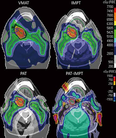 389-390期《全球肿瘤快讯》-102-.jpg 389-390期《全球肿瘤快讯》-102-.jpg