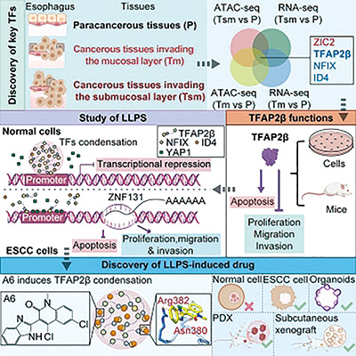 国人研究发现食管癌新药