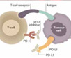 四种PD-L1免疫组化检测抗体分析