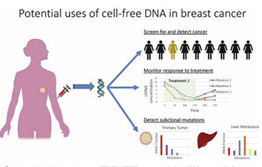 转移性三阴性乳腺癌 cfDNA肿瘤分数是不错的预后指标