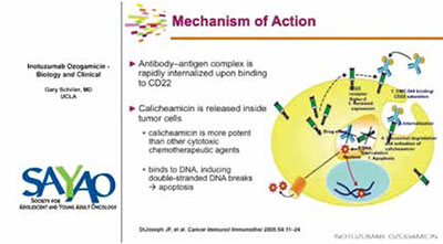 老年Ph染色体阴性ALL Inotuzumab ozogamicin联合低强度化疗的初步结果令人鼓舞 