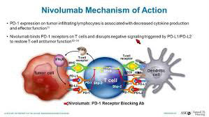 auto-HCT失败的难治复发经典型霍奇金淋巴瘤 Nivolumab治疗可获得长期疗效