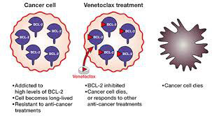 复发/难治套细胞淋巴瘤 Venetoclax联合伊布替尼可达到前所未有的疗效