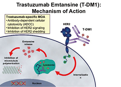 T-DM1复治HER2过表达晚期NSCLC有效