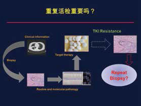 一线TKI治疗后二次活检率分析