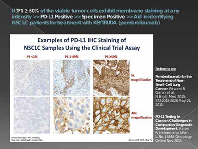 真实世界ⅢB/Ⅳ期NSCLC PD-L1 TPS≥50%和TPS≥1%无区域差异
