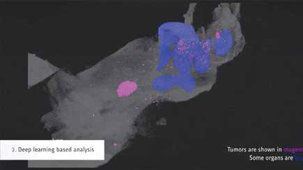 深度学习算法可揭示肿瘤转移和药物作用情况