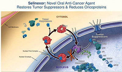 复发性或难治性DLBCL Selinexor单药缓解率达28%