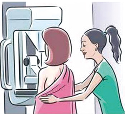 乳腺癌生存者继发原发癌风险因年龄和亚型而异