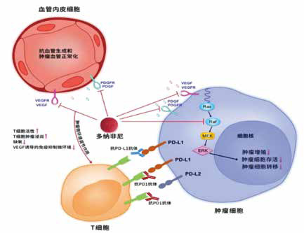 不可切除/转移性肝癌 多纳非尼一线治疗优于索拉非尼 