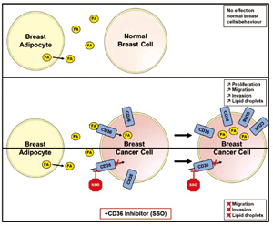 HER2阳性乳腺癌 CD36高表达预测新辅助曲妥珠单抗结局较差