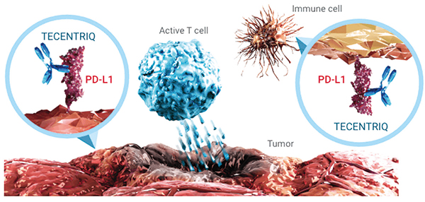 PD-L1 TC≥50%的Ⅱ~ⅢA期NSCLC 辅助治疗时联用阿替利珠单抗生存获益或更大