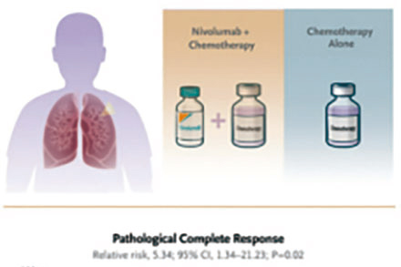 可切除的ⅢA/ⅢB期NSCLC 围手术期治疗添加纳武利尤单抗或更优