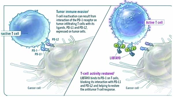 一线治疗晚期NSCLC Cemiplimab单药显著优于联合化疗