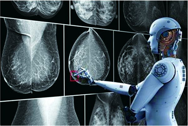 乳房X线摄影 AI支持的筛查读片与标准双人读片检出率相似