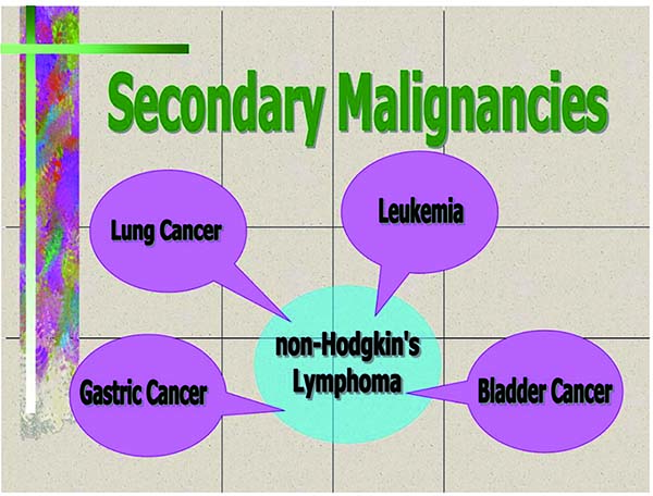 常规抗淋巴瘤治疗时 第二原发性恶性肿瘤的发生情况分析