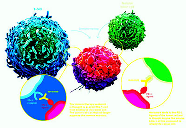 一线治疗晚期NSCLC Avelumab方案生存改善略优于标准方案