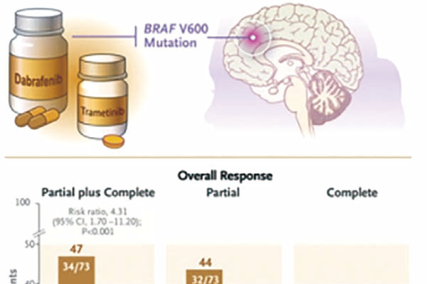 BRAF V600突变的低级别胶质瘤患儿 一线应用达拉非尼联用曲美替尼或优于标准化疗