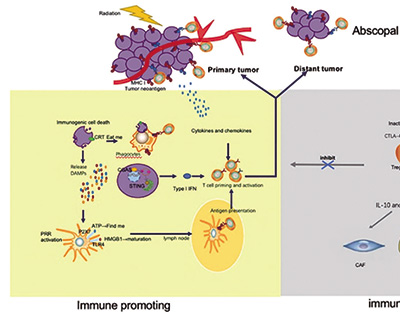 PD-L1 TPS≥50%局部晚期NSCLC 仅予放射免疫治疗而不予化疗或更佳