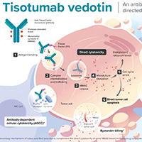 复发性宫颈癌 tisotumab vedotin二线或三线疗效优于化疗