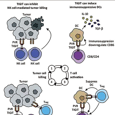初治的、高PD-L1的晚期NSCLC 联用tiragolumab对比单用阿替利珠单抗无明显益处 