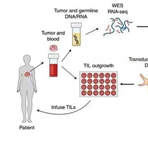 头颈部鳞癌新辅助免疫疗法使用率攀升