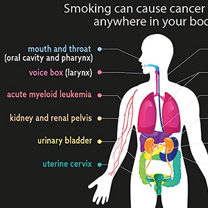 研究提示戒烟应作为肿瘤治疗过程中的一环