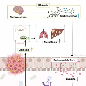 国人研究揭示压力促转移机制