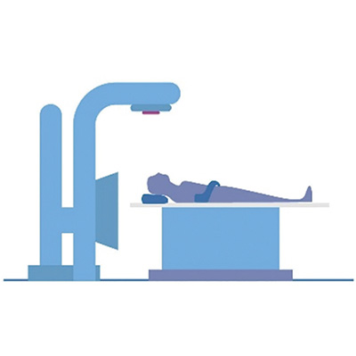 巩固性放疗改善SCLC的免疫治疗效果