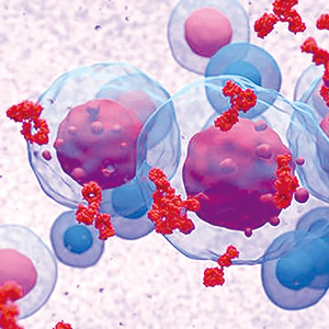 大B细胞淋巴瘤患者 先BsAb后CAR T的治疗顺序可能获益更大