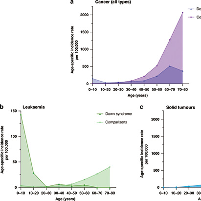 唐氏综合征患儿患癌风险分析