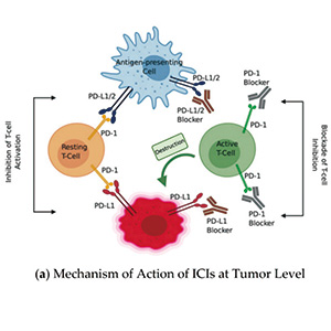 ICI抗癌时 ICI诱导的糖尿病罕见但不容忽视