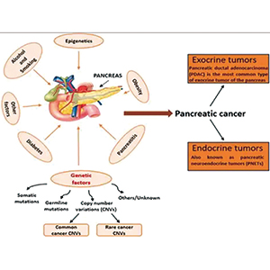 可切除及交界可切除胰腺癌 围手术治疗期间的静脉血栓栓塞事件与总生存相关