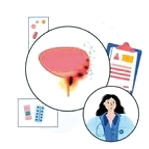 寡转移性前列腺癌 转移灶导向治疗的数据“引人瞩目”