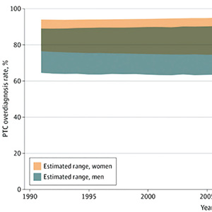 美近30年甲状腺乳头状癌过度诊断研究