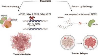 多线治疗失败的AML 含revumenib全口服方案或安全有效