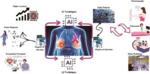 乳腺癌人工智能TIL评分研究